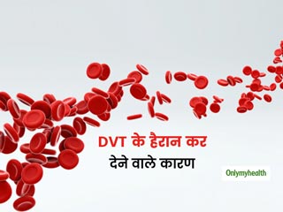 कहीं आपको तो नहीं डीप वेन थ्रांबोसिस? जानें किन कारणों से हाती है ये परेशानी